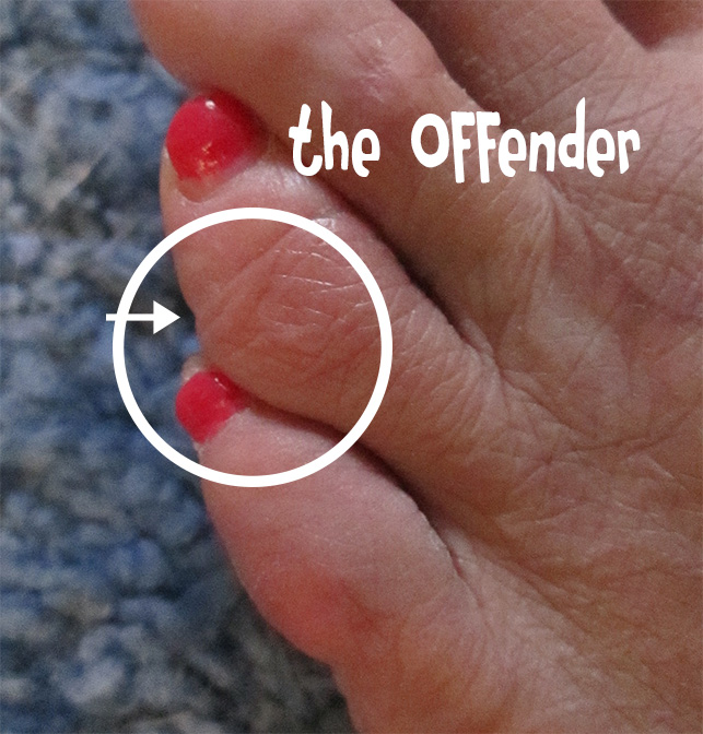The toe offender